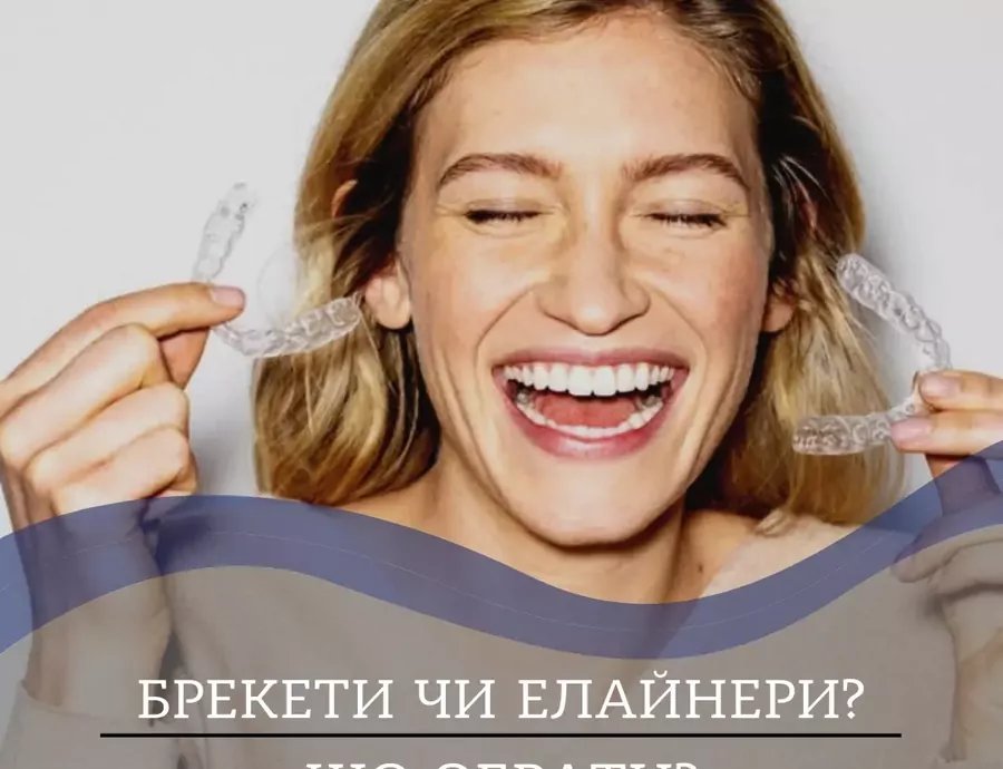 Элайнеры или брекеты: что выбрать для выравнивания зубов