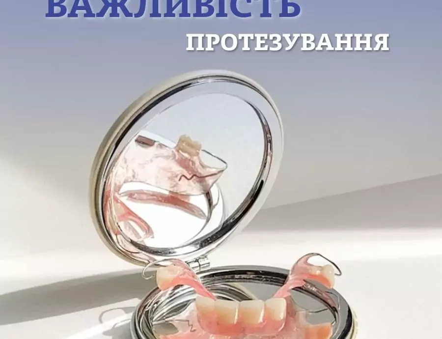 Нужно ли протезировать отсутствующие боковые зубы