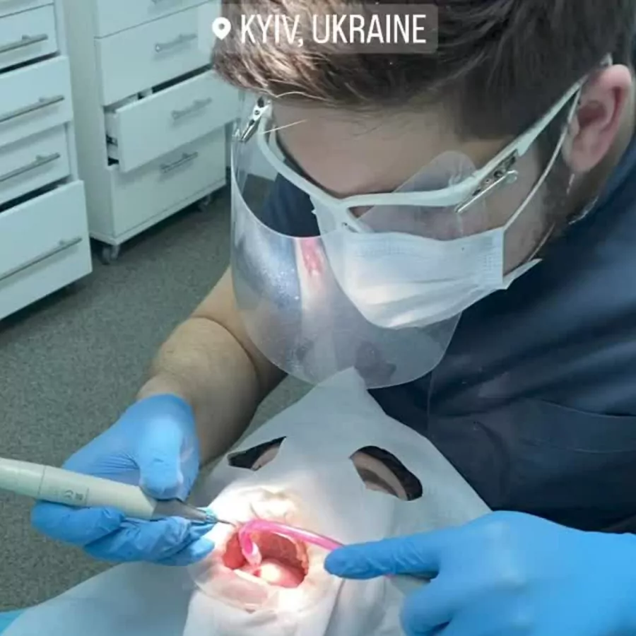 Лікар проводить професійну чистку зубів
